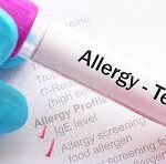 Allergy Test